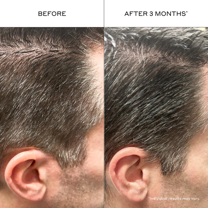 Before and after using Zenagen Eclipse shampoo and conditioner showing fuller-looking, healthier-looking hair with improved color appearance, enhanced shine, and reduced visible dullness after 3 months. Individual results may vary.