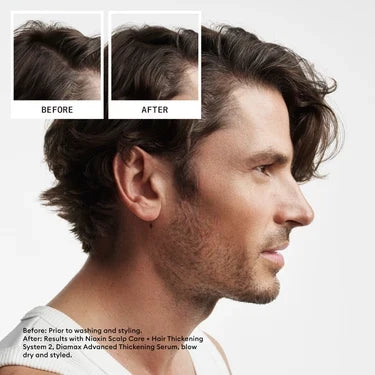 Nioxin System 2 Leave In Treatment 100ml - For Natural Hair with Progressed Thinning