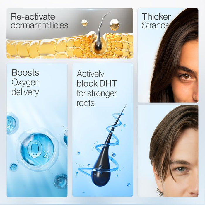✨  Bodywise Hair Growth Serum Roll-On – Boosts Roots, Revives Thinning Hair Naturally