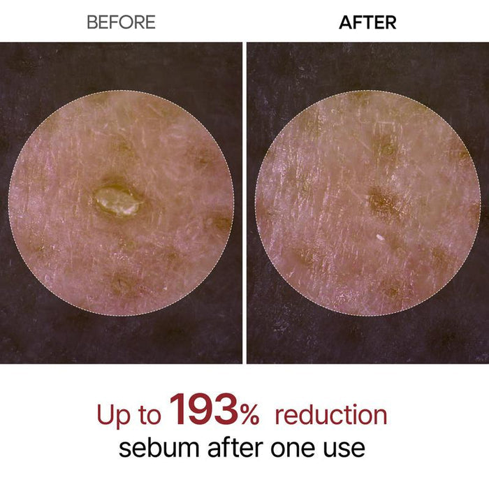 Dr.Melaxin Peel Shot Glow White and Black Rice Ampoule Duo, Soft Exfoliating Face and Body Scrub Dead Skin Cells, Blackheads Remover for All Skin Types