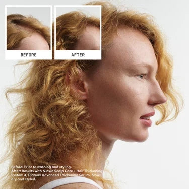 Nioxin System 4  Leave In Treatment 100ml - For Coloured Hair with Progressed Thinning