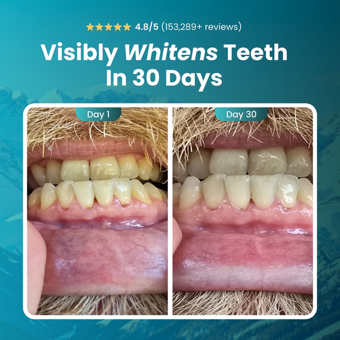 Remineralizing Gum, Underbrush Remineralizing Chewing Gum, Organic Mastic Mint Sugar-Sugar-Free for Whiten Teeth Health Chewing Gum to Keeps Your Mouth Fresh